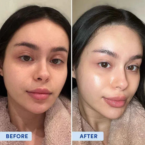 Korean HA PDRN orb serum